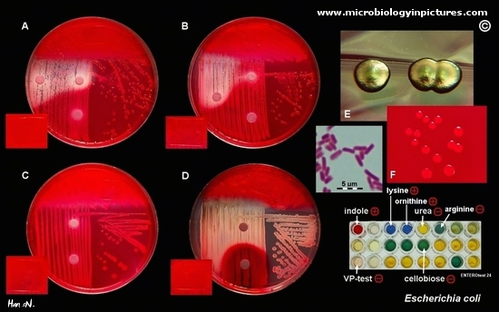 Escherichia coli picture